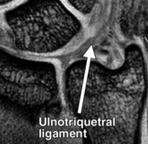 image17.PNG
