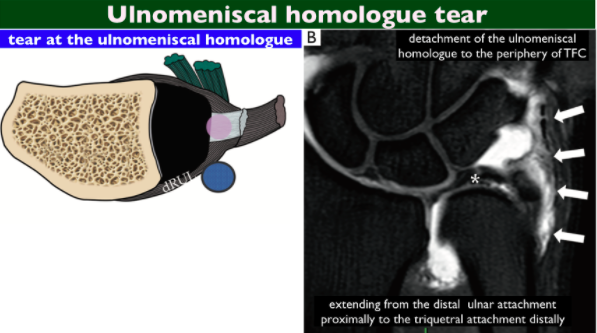 image46.PNG